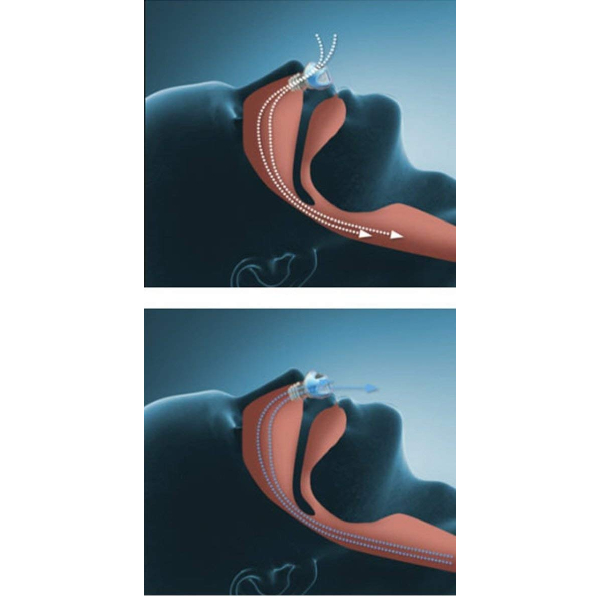 Horlama Önleyici Rahat Uyku Aparatı 