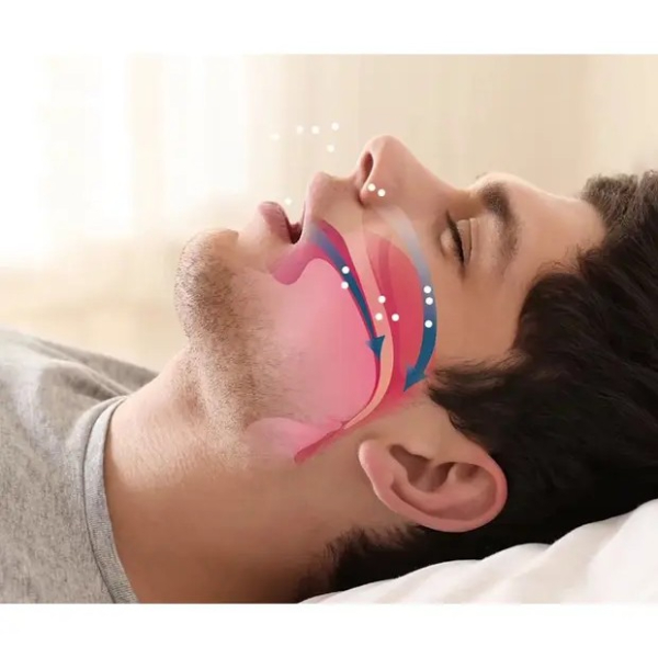 Horlama Önleyici Rahat Uyku Aparatı 